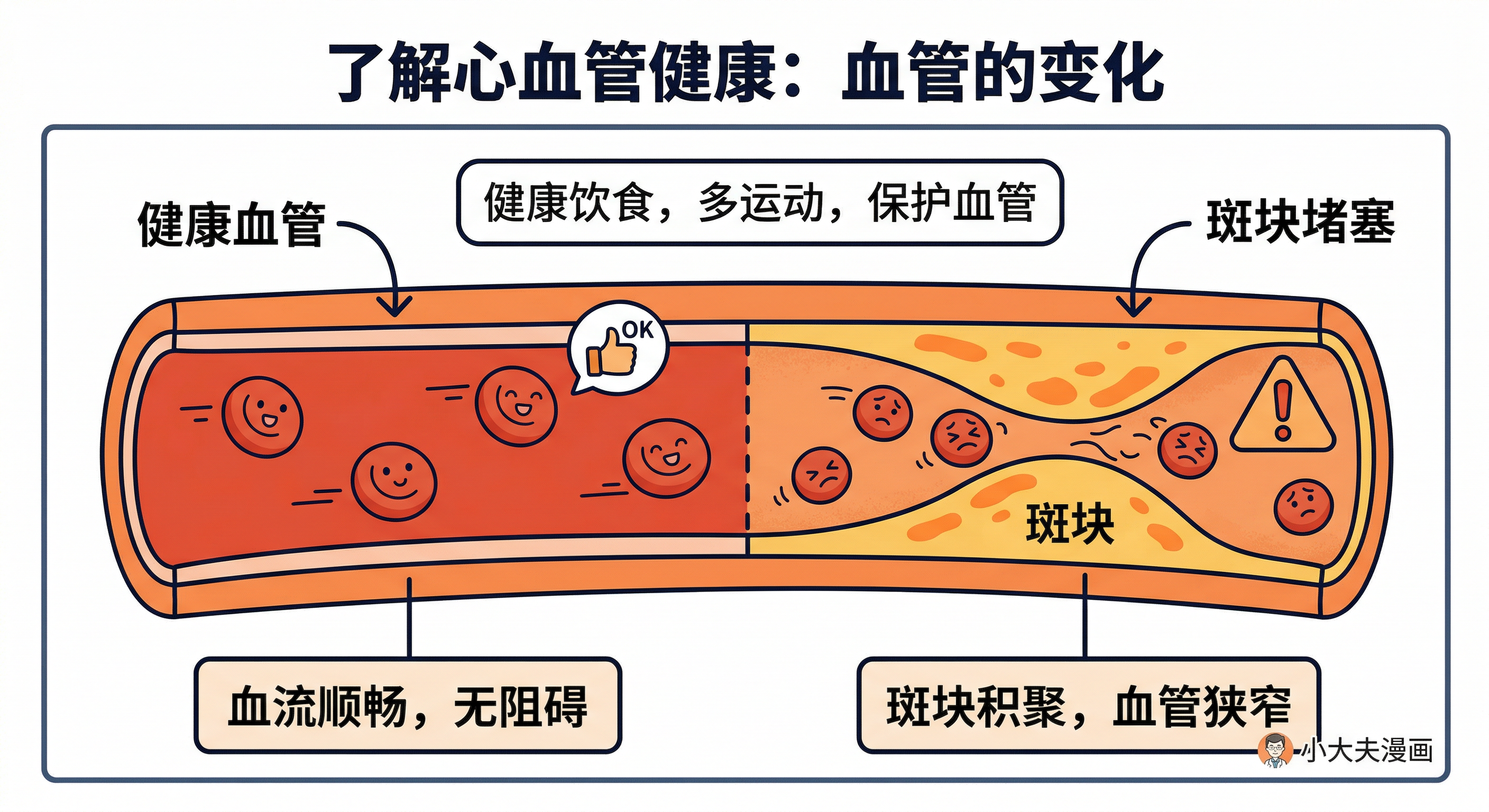 健康血管与斑块血管对比